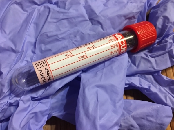 blood sample tube